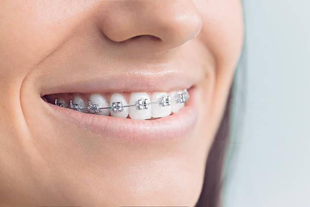 Best Root Canal Treatment  in Peebles, OH
